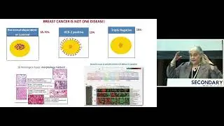 Bringing advanced breast cancer to centre stage - Dr Fatima Cardoso, ABC Global Alliance - Summit 25