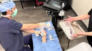 Ultrasound Guided Carpal Tunnel Release - AWAKE PATIENT - with SONEX US CTR