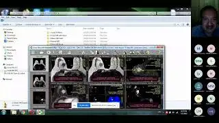 19th Session  Radiology Interactive Course Radiology Department, Benha University & Egyptian Society