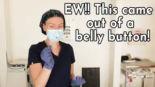 Clean your belly button!