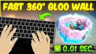 situp gloowall macro one click 360&deg; gloo peck in pc | most demanded video | all in one