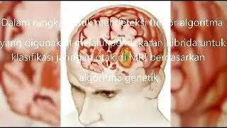 Image Processing Thecniques For The Enhancement Of Brain Tumor Patterns