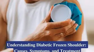 Frozen shoulder&nbsp;and #Diabetes connection #physiotherapy#study#frozenshoulder 