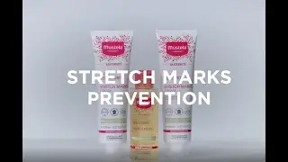 Mom Hacks: How to use Mustela&rsquo;s Stretch Marks Range
