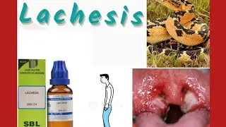 ||Lachesis|| ||Allen's keynote|| ||Homoeopathic medicine|| ||BHMS||