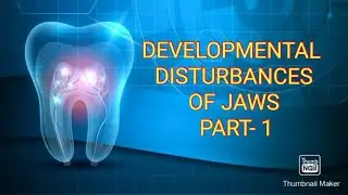 DEVELOPMENTAL DISTURBANCES OF JAWS PART- 1