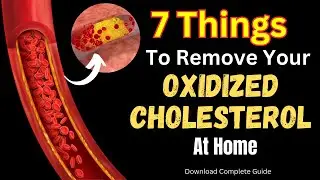 7 Effective Ways to Remove Oxidized Cholesterol from Your Body at Home