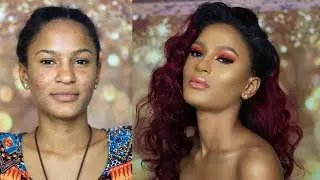 CLIENT TRANSFORMATION/HOW TO COVER ACNE/WIG ONLY