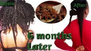 Use these 3 ingredients and your natural hair will not stop growing #4chair #hairgrowth
