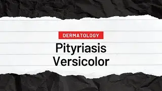 Pityriasis Versicolor - Dermatology 10 | MRCP Part 1 | Pass Medicine Revision