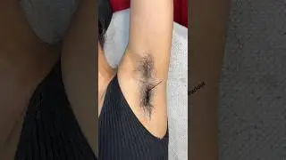 How to prep skin before armpit waxing/ #waxing #armpitwaxing #skincare ​⁠#beauty @pummybeautyworld