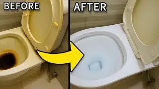 Try this and your dirty toilet will shine like new! Amazing tip!