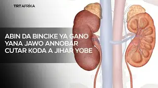 Abin da bincike ya gano yana jawo annobar cutar koda a Jihar Yobe