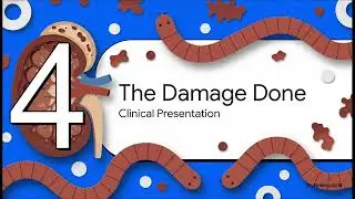 Dioctophyma renale (Гигантский почечный червь)