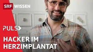 Herztod wegen Hackern &ndash; Wie realistisch ist der SRF-Tatort &laquo;Kammerflimmern&raquo;? | Puls | SRF Wissen