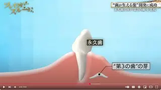Dr Katsu Takahashi and Toregem Biopharma .. A Revolution in Tooth Regeneration