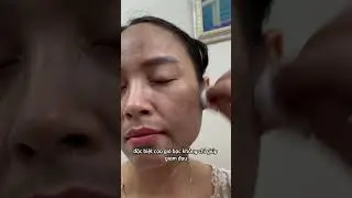 C&aacute;ch giảm đau thần kinh tọa với cạo gi&oacute; bạc