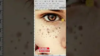 Remove Blemish from an image