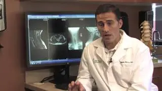 Dr Perry - Cervical Degenerative Disc Disease