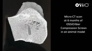 6 Month Micro-CT of OSSIOfiber Compression Screws