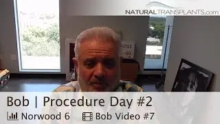 Hair Transplant Cost | Advanced HUE Method Bethesda, Maryland | Procedure Day (Bob)