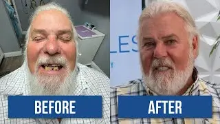Modern Day Smiles: From Hiding My Smile to Loving It &ndash; A Patient&rsquo;s Story of Dental Implants