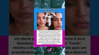 FAREI TRANSPLANTE O DRAMA DE GIOVANNA CORDEIRO AP&Oacute;S CORTE QU&Iacute;MICO NA SOBRANCELHA