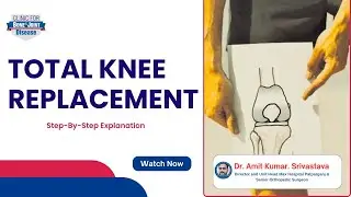 What We Do in Total Knee Replacement Surgery | Explained by Dr. Amit Kumar Srivastava