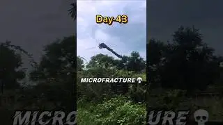 Day-43 (part-1) Microfracture Method🦴 #height #heightgrowth #growth #heightincrease