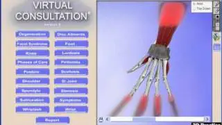 Virtual Consultation 3D Chiropractic Patient Education Software