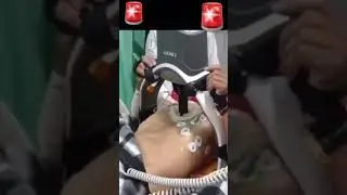Real use of LUCAS machine for Quality Chest Compression #cpr #heartattack