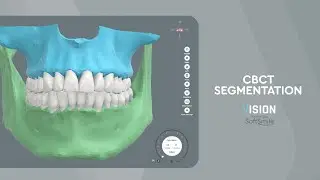 What is CBCT segmentation? A 3D Visual Walkthrough