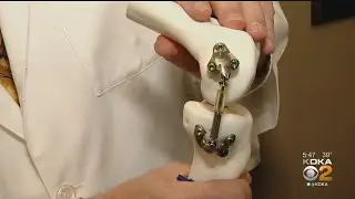New Device Aims To Delay Knee Replacements For Osteoarthritis Patients