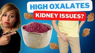The Surprising Truth: Can Beetroot Actually Trigger Kidney Stones?