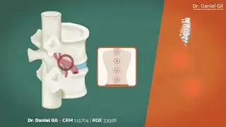 Dr.Daniel Gil - Radiofrequ&ecirc;ncia