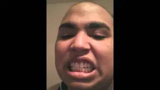 Black guy teeth
