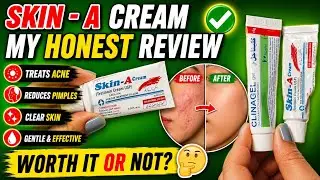 Skin A Cream real  Review | Fayde, Nuqsan & Results | Tooba Abdul Rehman