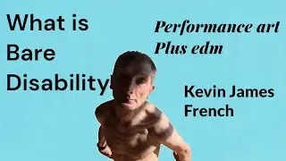 Kevin James French: EDM Producer & Performance Artist | Beyo &lsquo;Bare Disability&rsquo;&rdquo;