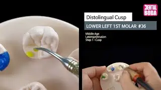 Lower Left 1st Molar  distolingual cusp 1 cusp (middle-aged) Wax-Up #36-3