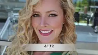 Congenitally Missing Teeth? Don't Miss This