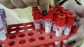 Blood Sample Collection Vial EDTA Vail and plane Vail Process