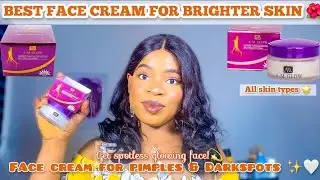 BEST FACE CREAM FOR PIMPLES AND DARK SPOTS |A.M GLOW FACE CREAM REVIEW +Face Cream For Brighter Skin