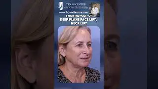 6 Months Post-Op Deep Plane Facelift & Neck Lift