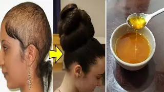 An Old Lady's Recipe Hair Grows Like Crazy and Doesn't Fall Out.