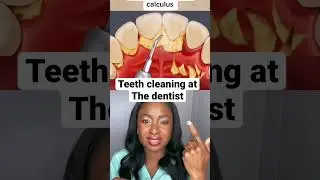 Teeth cleaning at the dentist  #shorts30&rsquo;#teethcleaning