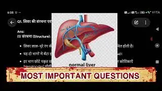 Liver &ndash; Structure, Function & Role in Digestion | Class 12 Important Question Answer ❓/ Biology 🧫