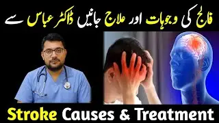 Stroke: The Silent Killer – Causes & Life-Saving Treatments You Must Know 