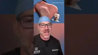 How Do You Reverse a Vasectomy? 🔄 #shorts