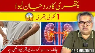 Kidney Stone Ka Dard: Symptoms, Treatment & Prevention | 2025 Health Guide