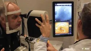 Einf&uuml;hrung in die navigierte Lasertherapie der Netzhaut mit Navilas 577s